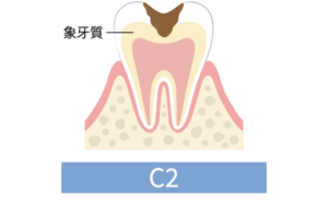 C2