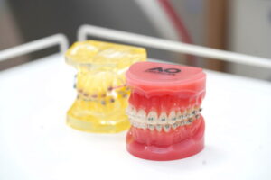 大学病院での経験を活かした矯正治療